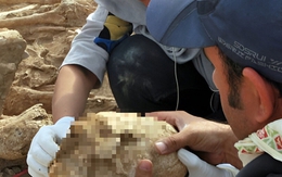 Phát hiện hài cốt cô gái Iran có hộp sọ "như ngoài hành tinh"