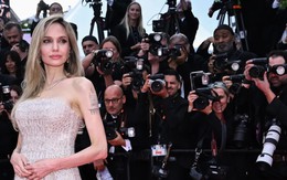 Liệt dây thần kinh số 7 - nỗi ám ảnh của các ngôi sao