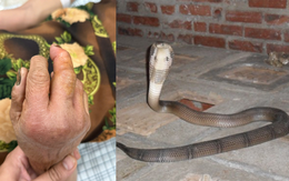 Ra chuồng gà vào buổi tối, người phụ nữ ở Phú Thọ phải đi cấp cứu với bàn tay sưng húp, đau nhức dữ dội