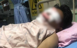 Thiết bị điện phát nổ khiến 3 người bị thương, cảnh sát điều tra phát hiện những dấu hiệu đáng ngờ