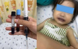 1 giờ sau khi ăn canh nấu bằng nước giếng, bé gái tím tái toàn thân, máu chuyển thành màu đen