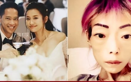 Bị chồng chê béo, sao nữ điên cuồng giảm còn 22kg, biến dạng như bà lão 70 tuổi