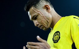 Tâm sự đau lòng của cầu thủ được ví như Ronaldo bị tạt axit gây rúng động: “Tôi không thể cười bình thường được nữa”
