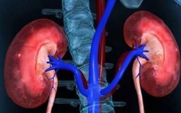 Dấu hiệu cảnh báo tổn thương thận cấp