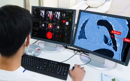 1 bệnh viện Việt Nam có siêu máy chụp CT hiếm trên thế giới: "Soi" tổn thương siêu nhỏ chỉ trong 2 giây