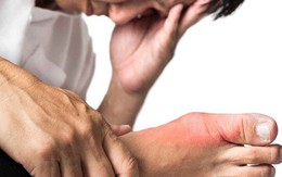 22 tuổi đã mắc gút, gan nhiễm mỡ, rối loạn mỡ máu: Nguyên nhân là ăn 1 thứ quá nhiều, làm 1 việc quá ít