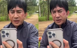 NSƯT Kim Tử Long gặp chấn thương, cả đoàn phim phải ngưng quay