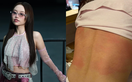 Phương Mỹ Chi gặp nguy, bác sĩ cũng đành bó tay