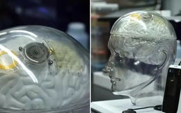 Trung Quốc thử nghiệm chip đọc não: Cạnh tranh nóng với Neuralink của Elon Musk