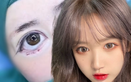 Trào lưu phẫu thuật thẩm mỹ dáng mắt minion ở Trung Quốc gây tranh luận, CĐM chỉ sợ mắt lúc ngủ khó mà nhắm lại được