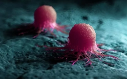 Vaccine Trung Quốc - Singapore ức chế tế bào ung thư gốc, ngăn tái phát và di căn