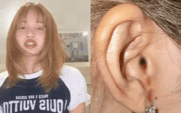 Lisa (BLACKPINK) lên tiếng về bức ảnh chảy máu tai gây hoang mang khắp MXH