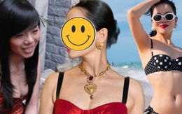 Phú bà Vbiz ở biệt thự hàng trăm tỷ suýt bị hoại tử vì phẫu thuật thẩm mỹ, phải huỷ show tháo sụn mũi gấp