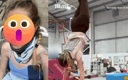 Kinh hoàng: Nữ y tá xinh đẹp ngã gãy cổ trong phòng tập thể dục, suýt bị liệt vì bác sĩ chuẩn đoán sai