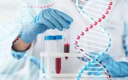 Ung thư thận gia tăng: Những dấu hiệu âm thầm dễ bị bỏ qua