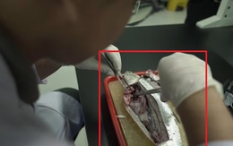Vi nhựa âm thầm "hạ độc" toàn Đông Nam Á: Việt Nam có phải là nước nuốt nhựa nhiều nhất?