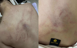 Nóng: Bé gái 4 tuổi bị cô giáo mầm non công lập ở Hà Nội bạo hành dã man, trích xuất camera phát hiện hành động gây sốc