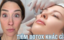 Tiêm botox vào một nửa khuôn mặt để xem ảnh hưởng thế nào đến vẻ bề ngoài: Nữ y tá "gây sốt" khi hé lộ kết quả!
