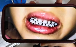 233 trẻ mầm non ở Thiên Thủy nhiễm độc chì nặng: Lộ tẩy sự thật kinh hoàng về nguyên liệu làm bánh