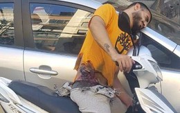 Đòn tấn công của Israel khiến hàng ngàn tay súng Hezbollah không thể hồi phục hoàn toàn