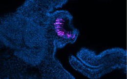 Loài vật có thể "mọc lại" cả nhãn cầu: Phát hiện mới mở kỳ vọng cho y học tái tạo của con người