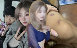 Chàng trai 19 tuổi bị bạn gái 17 tuổi bán sang Myanmar với giá 365 triệu đồng