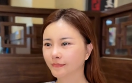 "Ác nữ" màn ảnh Việt công khai mặt sau thẩm mỹ: Khác quá không thể nhận ra