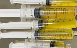 Hút ra 5 xi lanh "dịch vàng chanh" từ đầu gối người đàn ông sau khi uống 3 cốc bia