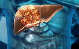 Người có gan yếu thường có 7 thói quen này: Cái cuối cùng nhiều người không ngờ tới