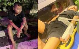 Hai thanh niên "thông chốt" đường cấm, tông thẳng vào cảnh sát cơ động sẽ đối diện với án phạt rất nặng