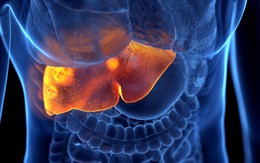 Tưởng sẽ chết vì suy gan, nhưng chỉ sau khi làm 1 điều, gan hồi phục kỳ diệu