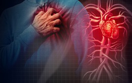 Người có mạch máu tắc nghẽn thường có 4 điểm chung: Kiểm tra ngay xem bạn có không?