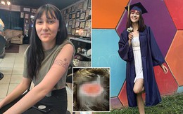 Tóc bốc khói, da đầu bong tróc từng mảng sau khi làm điều này: Nhiều người rất mê