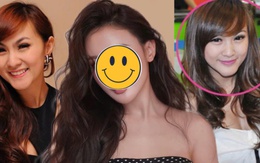 Mỹ nhân Việt khốn đốn vì phẫu thuật hỏng, suýt phải bỏ cằm do hoại tử