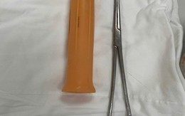 Cấp cứu nam thanh niên 23 tuổi ở TP.HCM bị kẹt cán cây lau nhà khoảng 15cm trong hậu môn