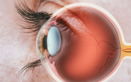 Thận khỏe hay không, nhìn mắt cũng biết: Có 5 dấu hiệu này hãy cẩn trọng