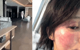 Mỹ nam lộ clip đưa gái lạ đi Phú Quốc bị vợ cũ tố cáo bạo hành đến biến dạng mặt mũi, sảy thai