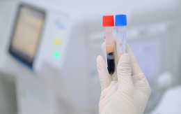 Ăn chay, gầy gò như “xác ve” vẫn sốc vì mỡ máu cao: Bác sĩ chỉ ra "thủ phạm" quen mặt