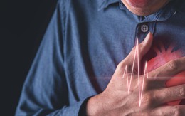 Phát hiện thêm nguyên nhân gây nhồi máu cơ tim