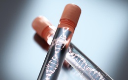 Nghe đồng nghiệp nói 1 câu, người đàn ông lặng lẽ đi xét nghiệm ADN, bật khóc khi biết kết quả