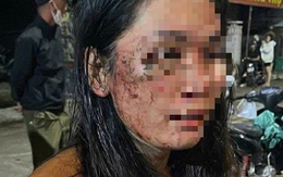 Diễn biến mới vụ nữ shipper tố bị khách hàng hành hung