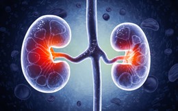 Cảnh báo thói quen âm thầm “phá” thận, dẫn lỗi cho loạt bệnh tật: Nhiều người đang làm mỗi ngày
