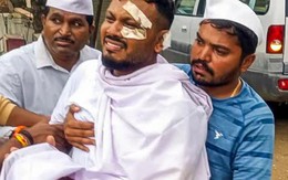 Tình hình hiện tại của người sống sót duy nhất trong thảm kịch máy bay Air India sau 3 tháng