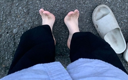 4 dấu hiệu "lạ" ở chân cảnh báo phổi "chi chít khối u", cần khám nhanh kẻo muộn!