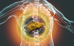 Khi gan suy nặng, cơ thể sẽ sưng ở 5 chỗ: Có 1 cũng nên đi khám ngay