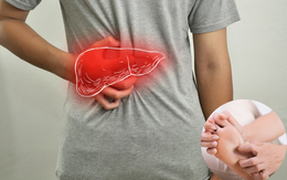 Muốn biết gan khoẻ hay yếu cứ nhìn vào chân sẽ rõ: Có 1 trong 5 dấu hiệu này nên đi khám ngay!