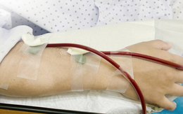 Ăn uống lành mạnh, chăm tập thể dục nhưng phải cắt cả 2 thận chỉ trong vòng 1 năm: "Thủ phạm" lộ diện