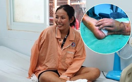 CĐM vỡ òa trước kỳ tích y học Việt Nam: Thai phụ bị tai nạn, được ghép tạm bàn tay đứt lìa vào chân chờ ngày nối lại