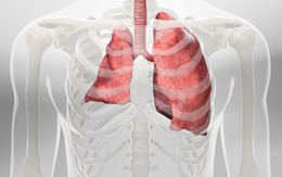 Đang khỏe mạnh bỗng bị xẹp phổi, thanh niên 24 tuổi hối hận vì đã làm 1 điều suốt gần 10 năm