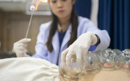 Liệt nửa người sau khi cạo gió giác hơi